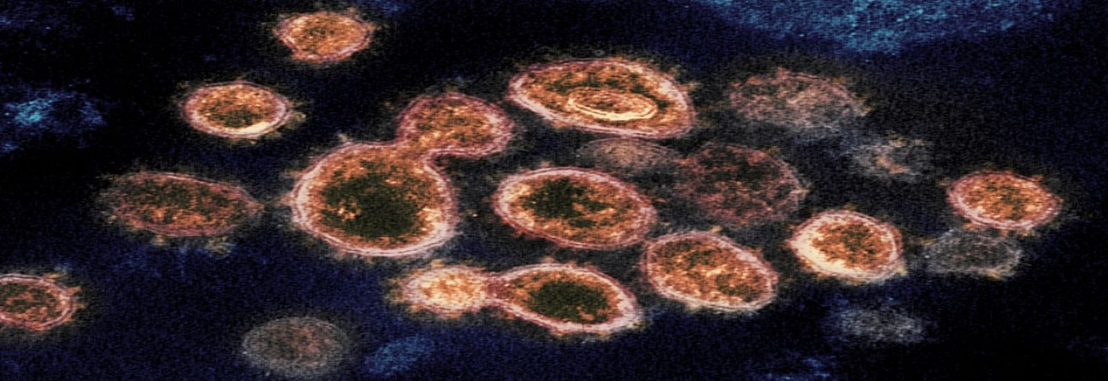 coronavirus2.jpg